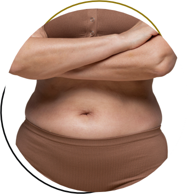 Abdominoplastia Reversa